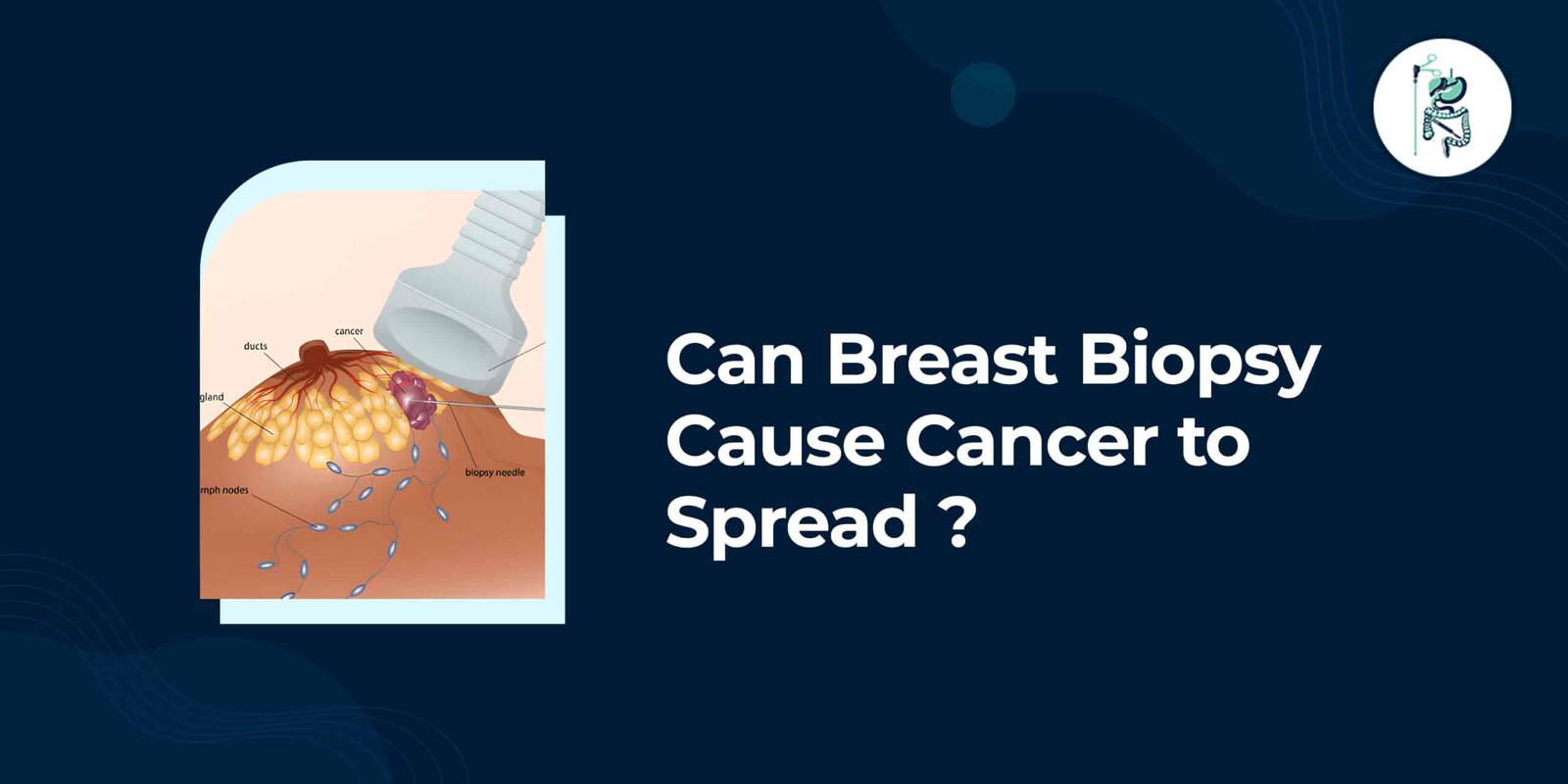 Can Breast Biopsy Cause Cancer to Spread