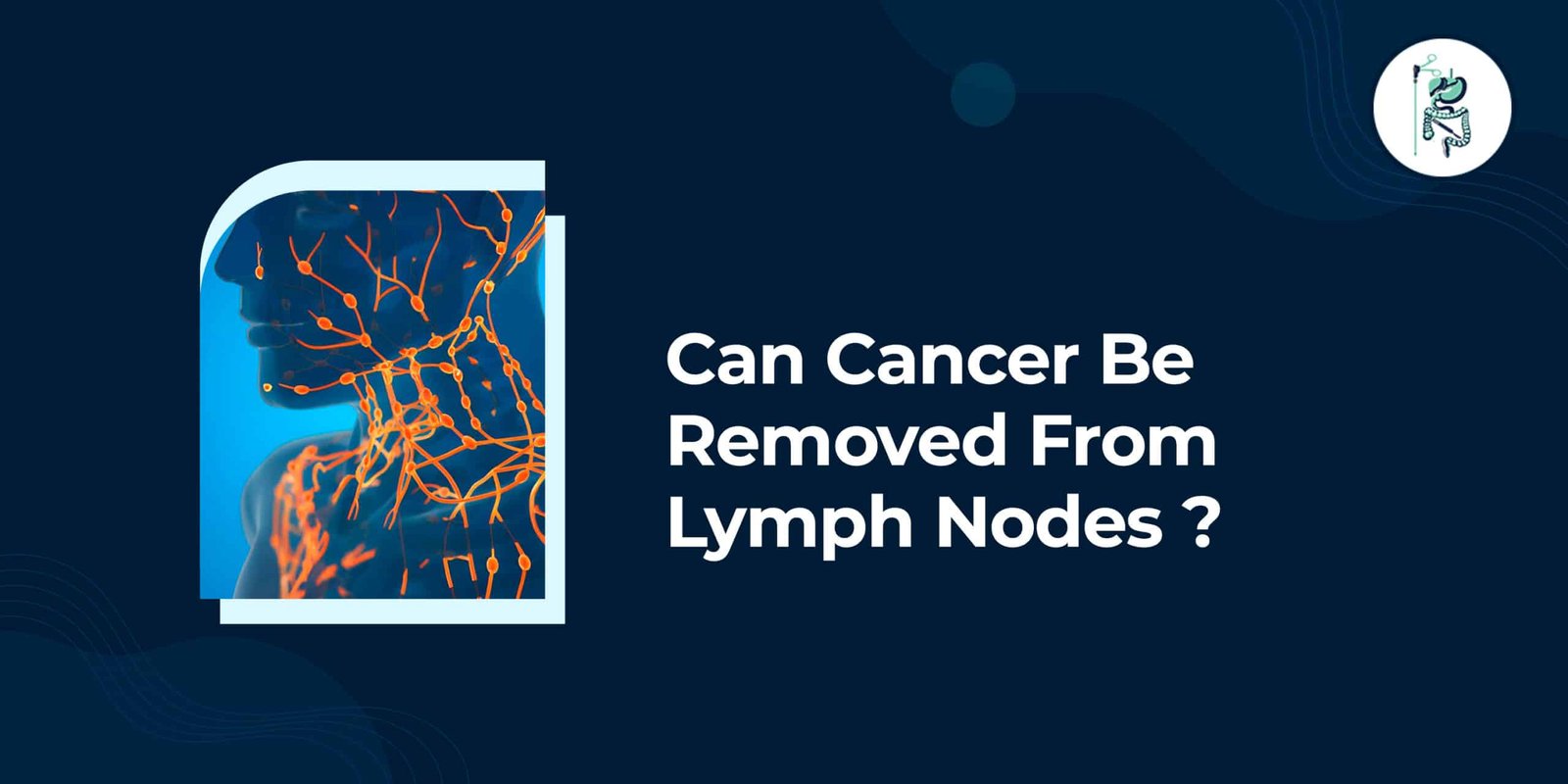 Can Cancer Be Removed from Lymph Nodes