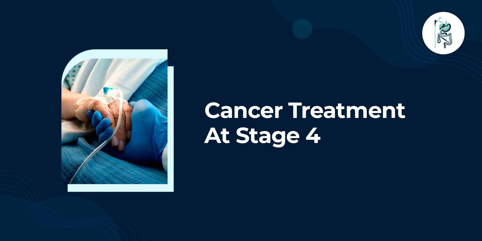 Cancer Treatment at Stage 4