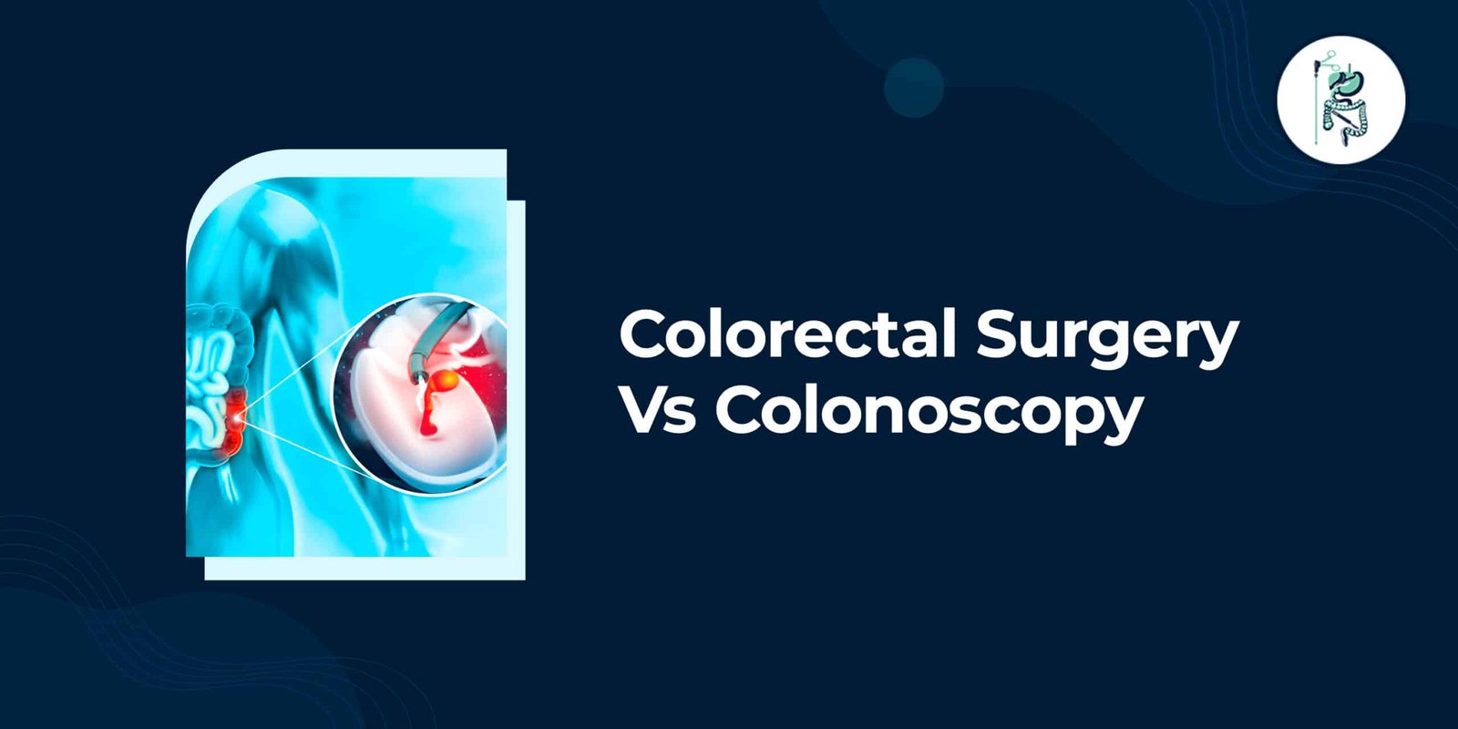 Colorectal Surgery vs Colonoscopy