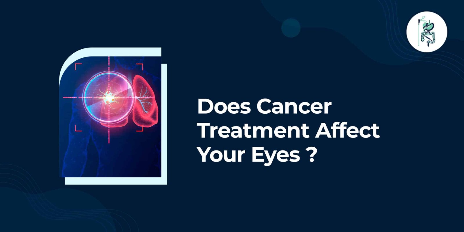 Does Cancer Treatment Affect Your Eyes?