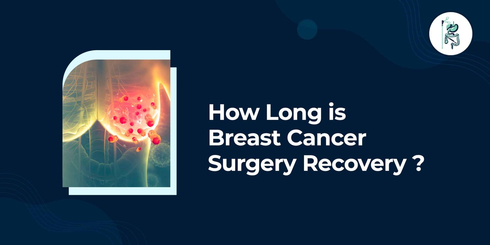 How Long is Breast Cancer Surgery Recovery