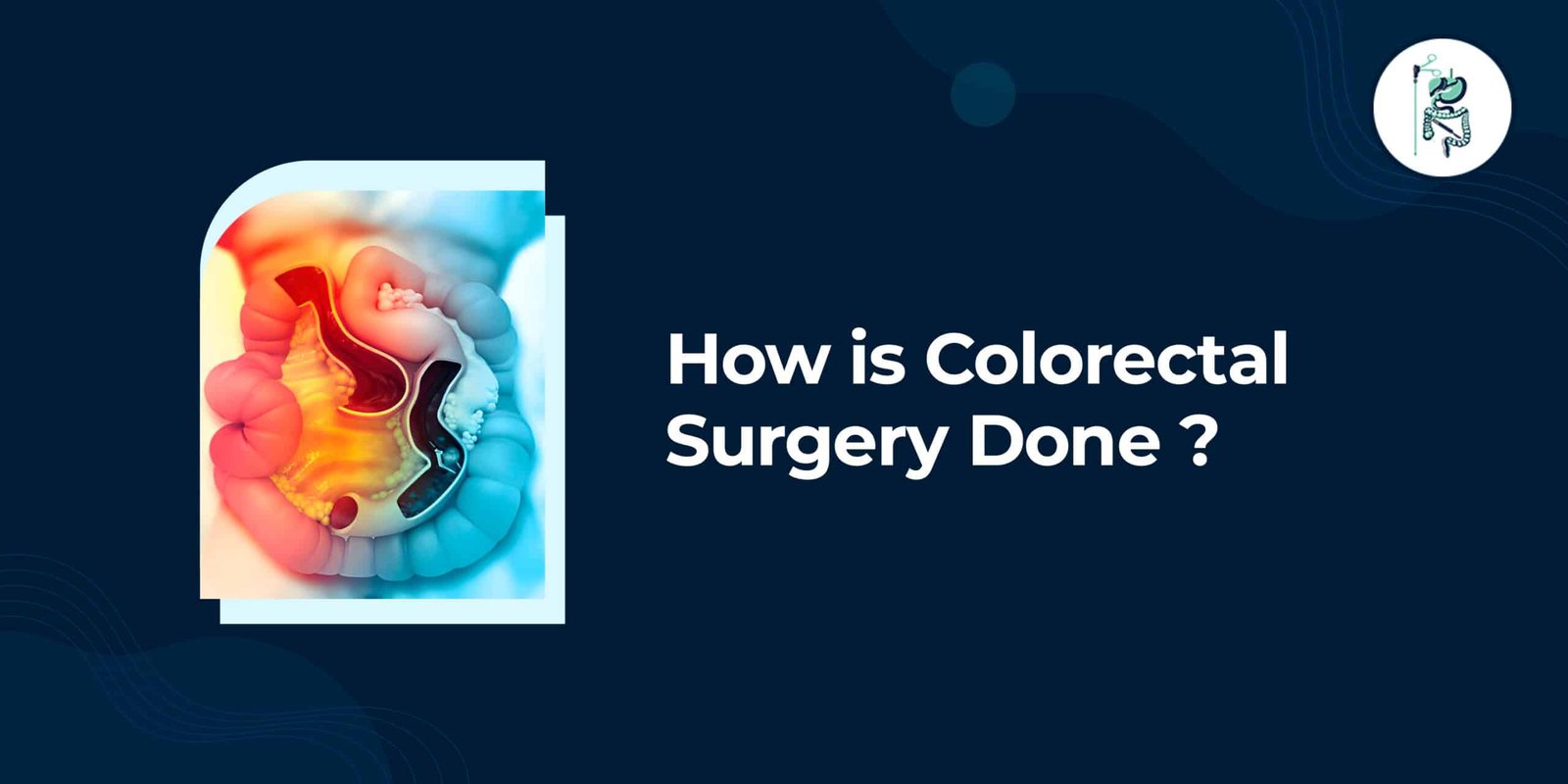 how is colorectal surgery done