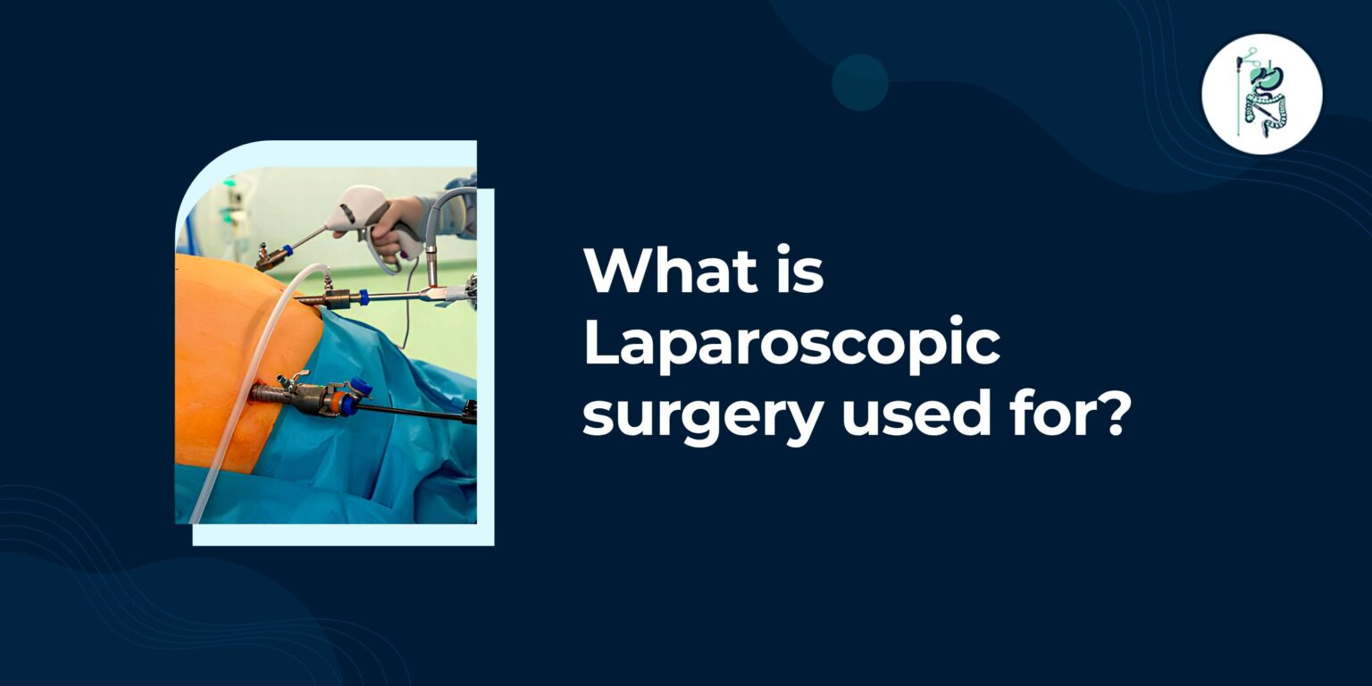 Gallbladder Surgery in Siliguri: Expert Laparoscopic Treatment & Recovery Guide